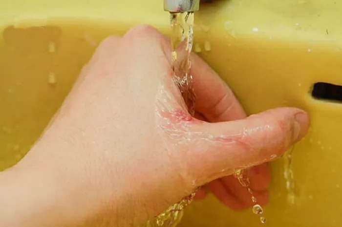 cach-xu-ly-khi-bi-meo-cao-can-ma-cac-ban-nen-biet2