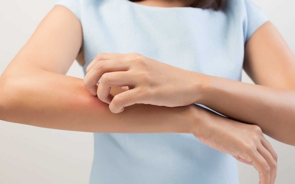 Dị ứng da gây ngứa ngáy, khó chịu